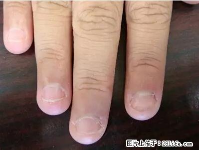 剪指甲、挖耳屎,这些日常小动作竟隐藏大危害! - 鹰潭生活资讯 - 鹰潭28生活网 yingtan.28life.com